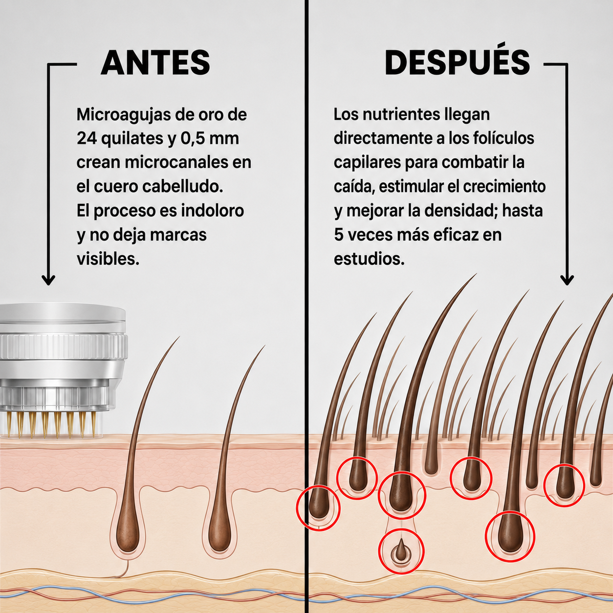 Ciclo de crecimiento del cabello potenciado con Micro-Infusión Capilar